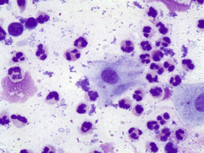 bakterii-vyzyvayushchie-prostatit